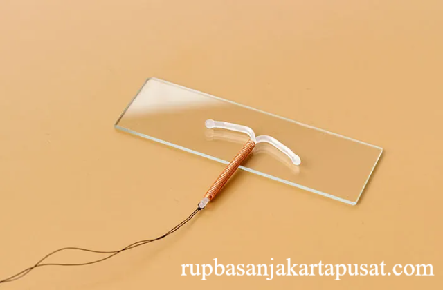 IUD dan Fungsinya dalam Keluarga Berencana